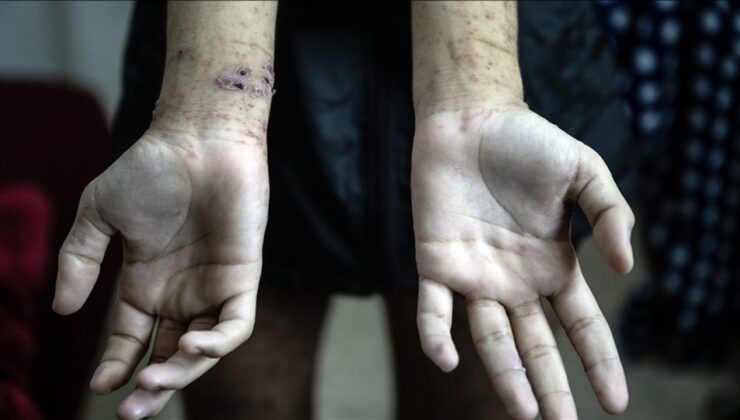 İşgalci hapishanelerindeki Gazzeli tutuklular, en korkunç koşullara maruz kalıyor