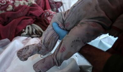 Gazze’deki Sağlık Bakanlığı: Yetersiz beslenme nedeniyle 52 çocuk öldü, sayı daha da artabilir