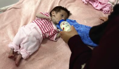 UNICEF: Haziran ayında Gazze’de 5800 çocuğa yetersiz beslenme teşhisi konuldu