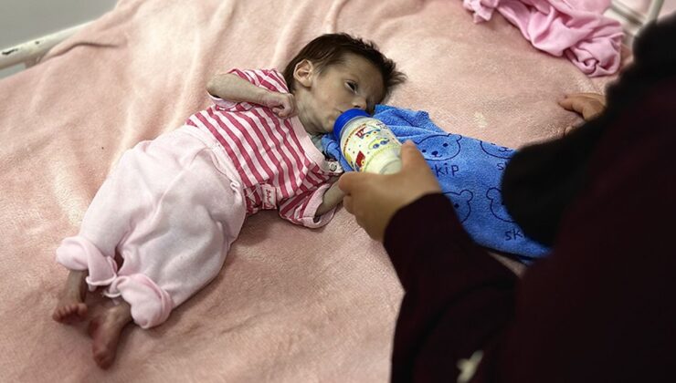UNICEF: Haziran ayında Gazze’de 5800 çocuğa yetersiz beslenme teşhisi konuldu