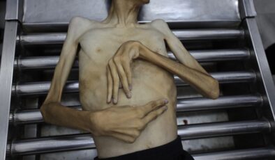 İşgalcilerin kıtlığı dayattığı Gazze’de son 24 saatte 3 kişi daha açlıktan şehit oldu